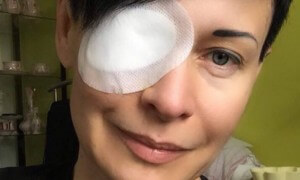Multifokální čočka - Oční klinika Neovize